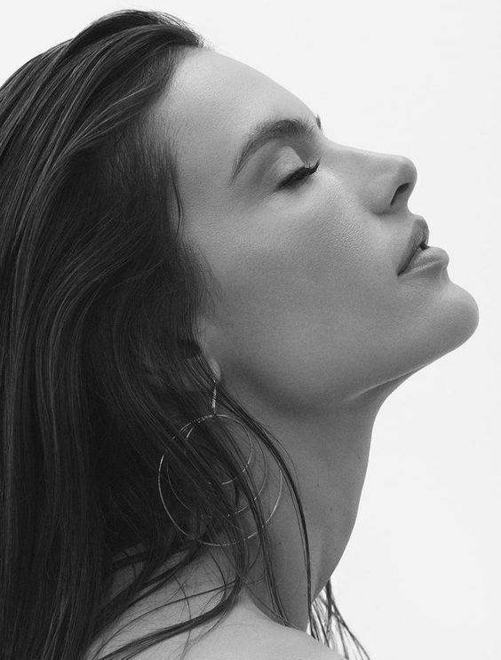 Woman with balanced facial profile representing non surgical rhinoplasty and facial balancing treatments at Lévy Aesthetics