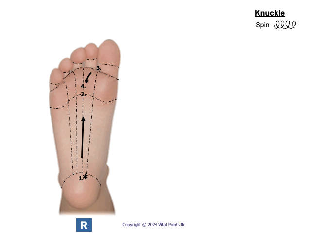 Spin only vena Cava.gif