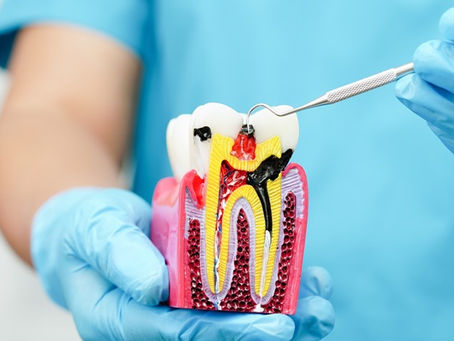 Healing after root canal therapy - Best Dentist Clinic Al Rigga Dubai