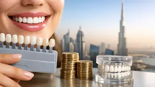 How Much Do Veneers Cost in Dubai? 2026 Prices
