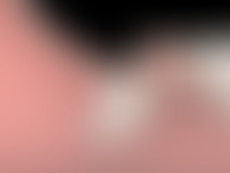 What are wisdom teeth, and should they be removed?