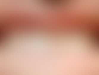 Tooth Injury: Broken or Missing Tooth