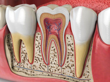 Recovery Process After a Root Canal Treatment - Best Dentist Clinic Al Rigga Dubai