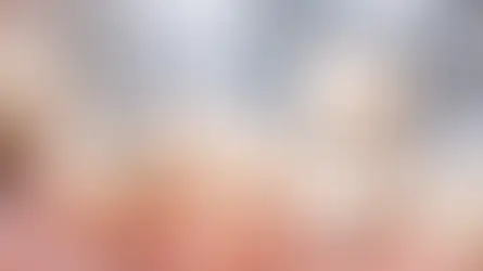 Tooth Filling vs Crown for a Damaged Tooth