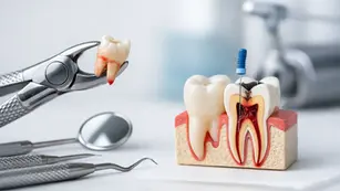 Tooth Extraction Versus Root Canal: Which Is Right?