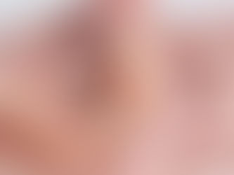 Visit the Best Dentist in Al Rigga, Dubai for Cost-Effective Dentures