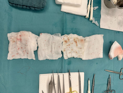 Fordyce Drüsen im Intimbereich: Symptome, Ursachen, Diagnose und Behandlung mit der Mikrostanzen-Technik