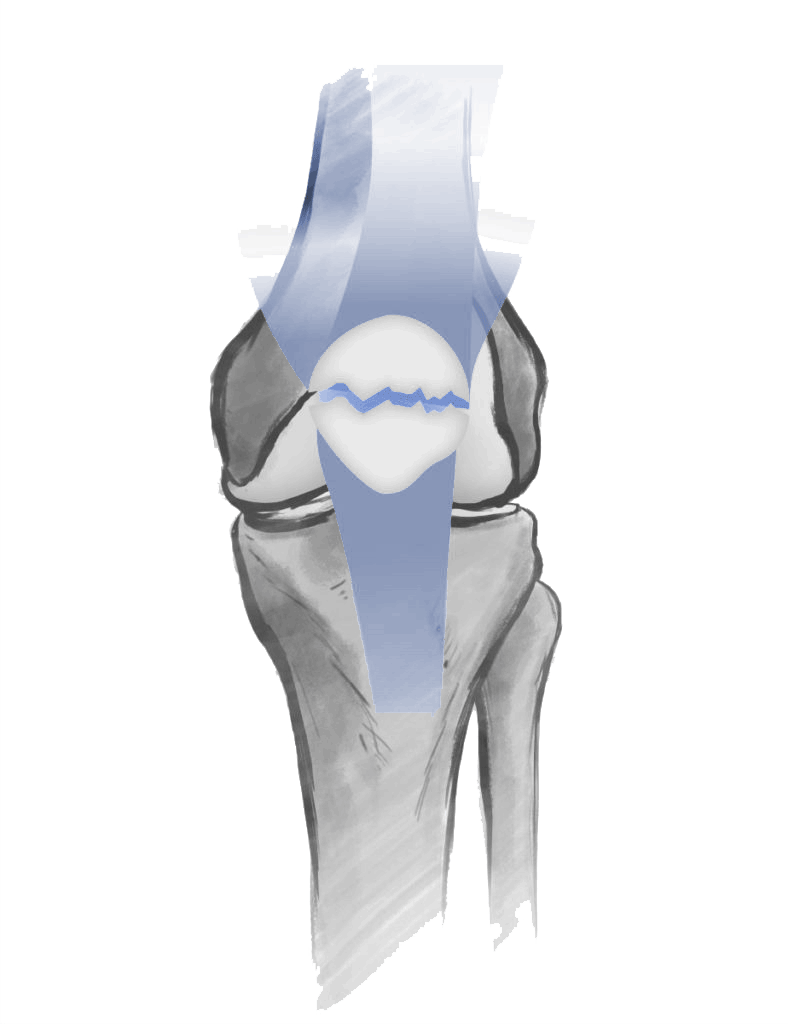 The Dubai Hip and Knee Institute (DHKI) - Dr Hervé Ouanezar