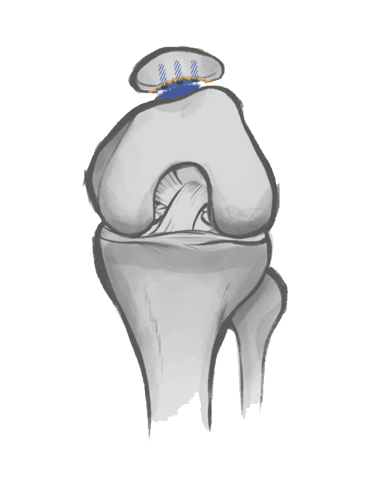 The Dubai Hip and Knee Institute (DHKI) - Dr Hervé Ouanezar