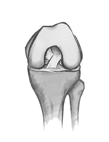 The Dubai Hip and Knee Institute (DHKI) - Dr Hervé Ouanezar