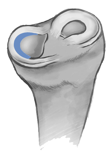 The Dubai Hip and Knee Institute (DHKI) - Dr Hervé Ouanezar