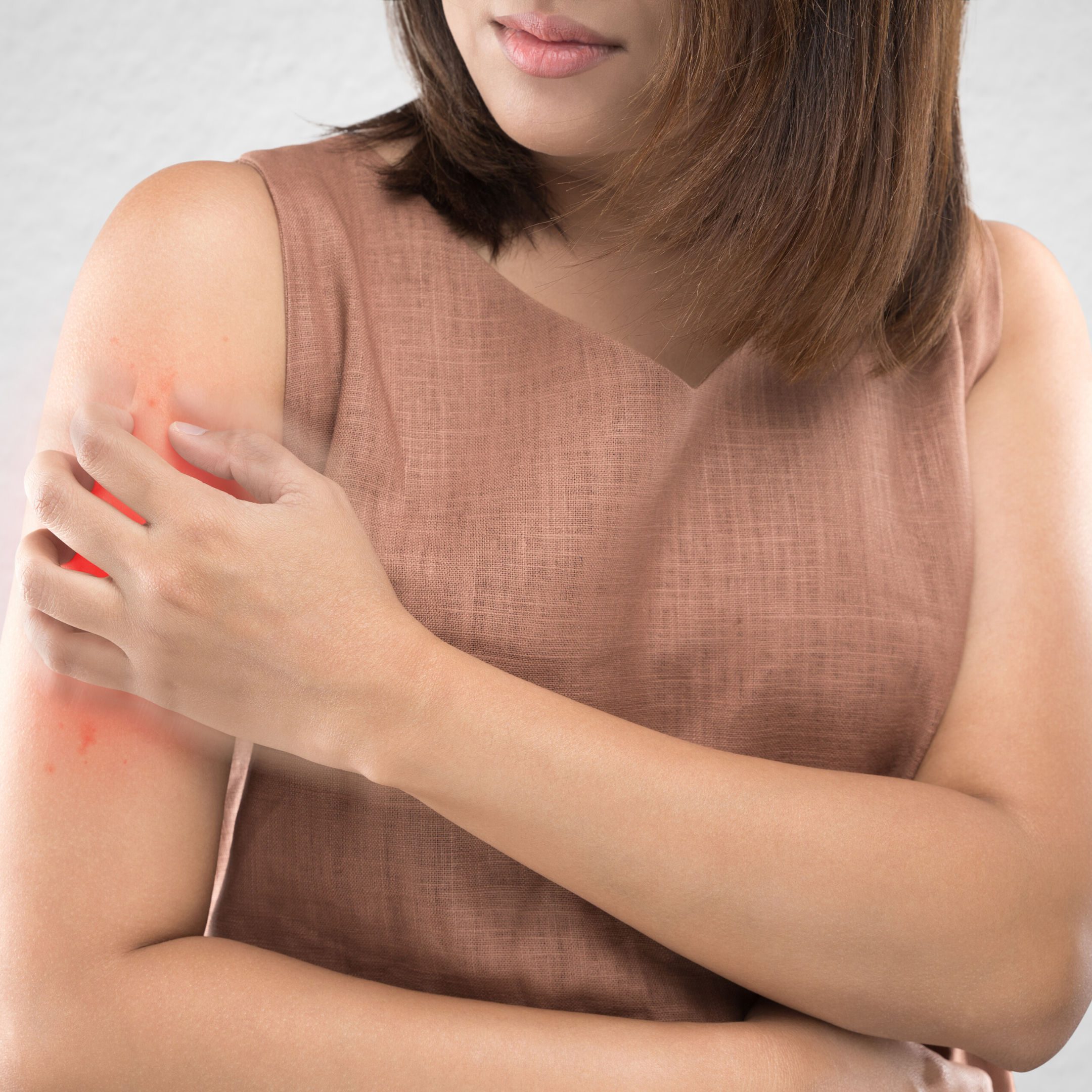 Conheça a dermatite herpetiforme