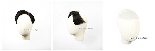 Hair Blooms Wigs | 男士脫髮 | 地中 | 海禿頭 | M 字額 | 醫療假髮 | 化療脫髮 | 鬼剃頭 | 醫療脫髮 medical wig hairpiece toupee shop in causeway bay, hong kong