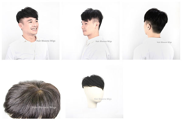 Hair Blooms Wigs | 男士脫髮 | 地中海 | 禿頭 | M字額 | 醫療假髮 | 化療脫髮 | 鬼剃頭 | 醫療脫髮 | 髮片, 醫療假髮, 香港, 銅鑼灣, 假髮, medical wig hairpiece, wig shop, causeay bay, hong kong