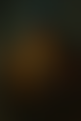 הבחנה במקרה של ספק נגיעה