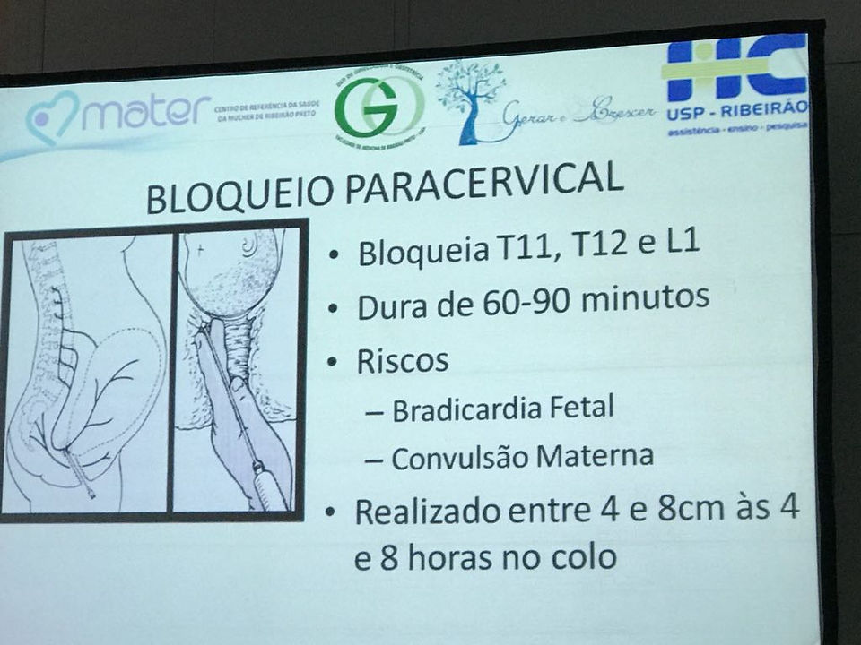 Analgesia de parto