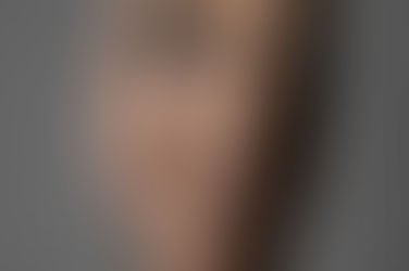 What Is a Brazilian Butt Lift and How Does It Work?