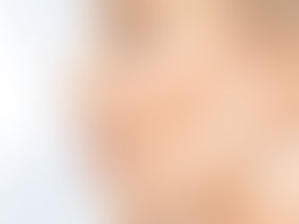 كيفية الاستعداد لجراحة التجميل في دبي
