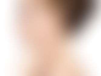 كل ما تحتاج لمعرفته حول إعادة تشكيل الأذن في دبي