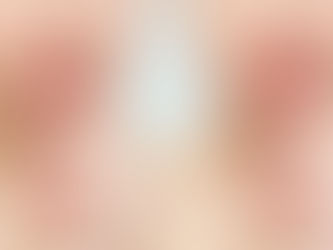 What Are Russian Lip Fillers?