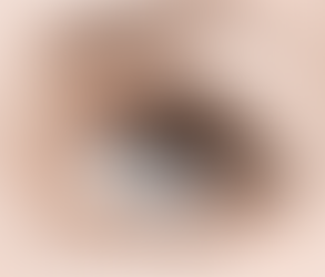 قم بتغيير شكل حاجبيك من خلال عملية زراعة شعر الحاجب