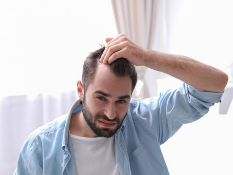الدليل الشامل لزراعة الشعر المباشرة ما تحتاج إلى معرفته