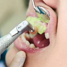 istockphoto-1042470044-612x612_edited.pn