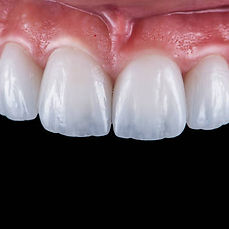 istockphoto-1488900490-612x612_edited.jpg