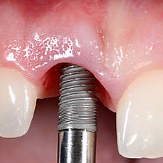 istockphoto-601918330-612x612_edited_edited.jpg