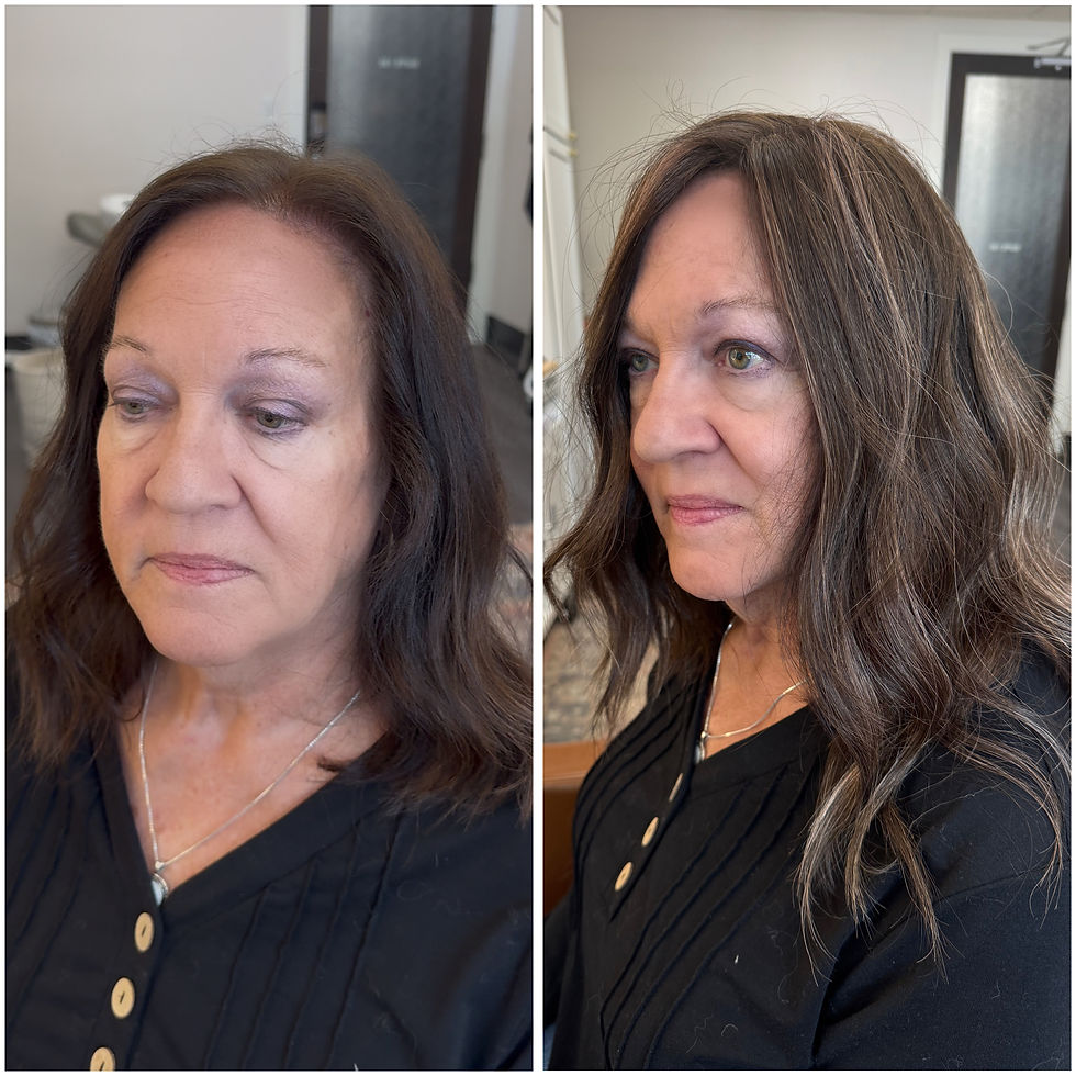 Hair topper for receding hair line