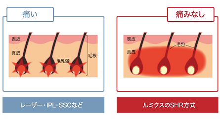 list_lumix_a9_span_left (1).png