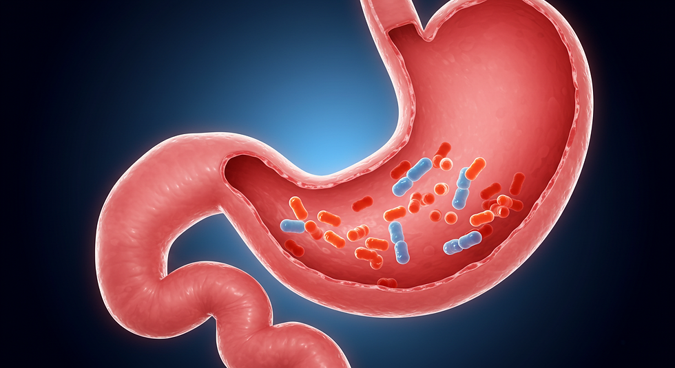 Dispepsia Funcional