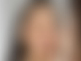 FACETAS DE PORCELANA VS. OUTROS TRATAMENTOS ESTÉTICOS — QUAL O MELHOR PARA O SEU SORRISO?