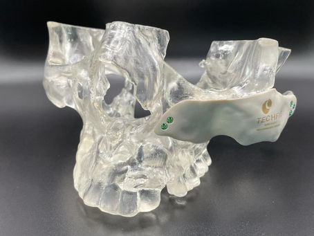 The Crucial Role of Raw Materials in Innovative Medical Devices
