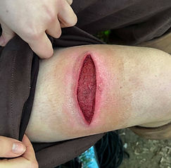 Leg Gash_edited.jpg