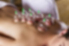 cupping-therapy-.jpg