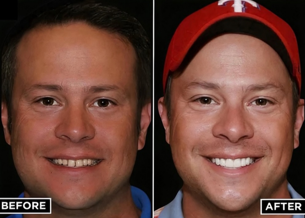 smile upgrades mansfield texas dentist dr sandi hamm dental work smile upgrade patient res