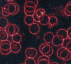 Blood cells after wearing magnetic bracelet Australia