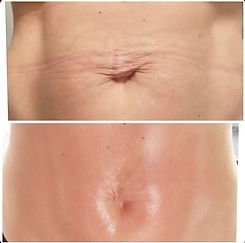Stomach.jpg