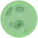 Miniatura: Gangrena de GIANTmicrobes
