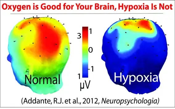 Graphic comparing EEG brain activity between a Normal state and Hypoxia, showing a dramatic reduction in electrical activity when oxygen is depleted. While the normal brain displays widespread activity (red and orange), the hypoxic brain is almost entirely inactive (deep blue)
