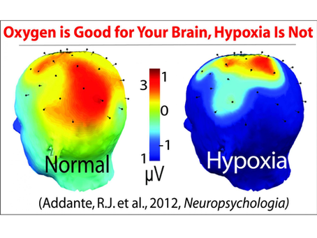 Hypoxia: The Silent Threat in Air Defence