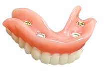 A top, implant-supported denture.