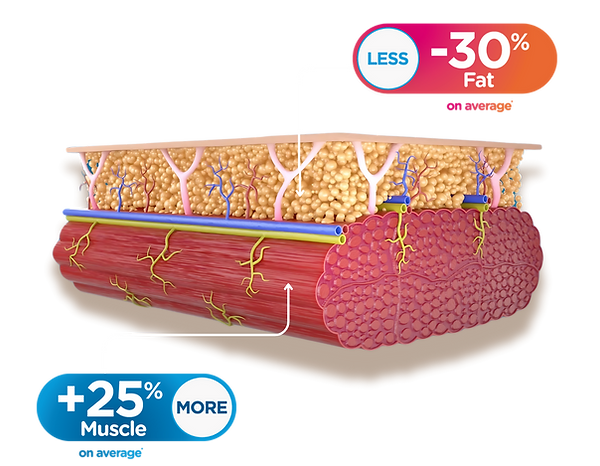 EmSculpt NEO muscle fat diagram. +25% muscle -30% fat on average