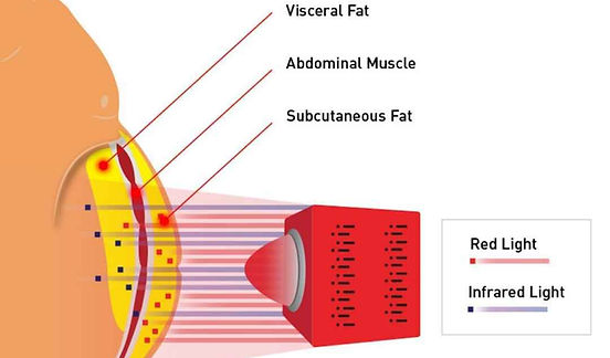 Red Light Treatment Diagram