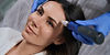 Microneedling treatment for skin rejuvenation