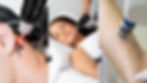 Picosecond laser vs RF microneedling vs fractional ablative laser