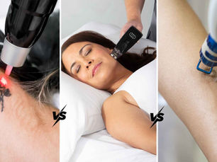 Laser Treatment Comparison