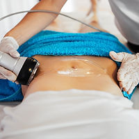 Cavitation.jpg