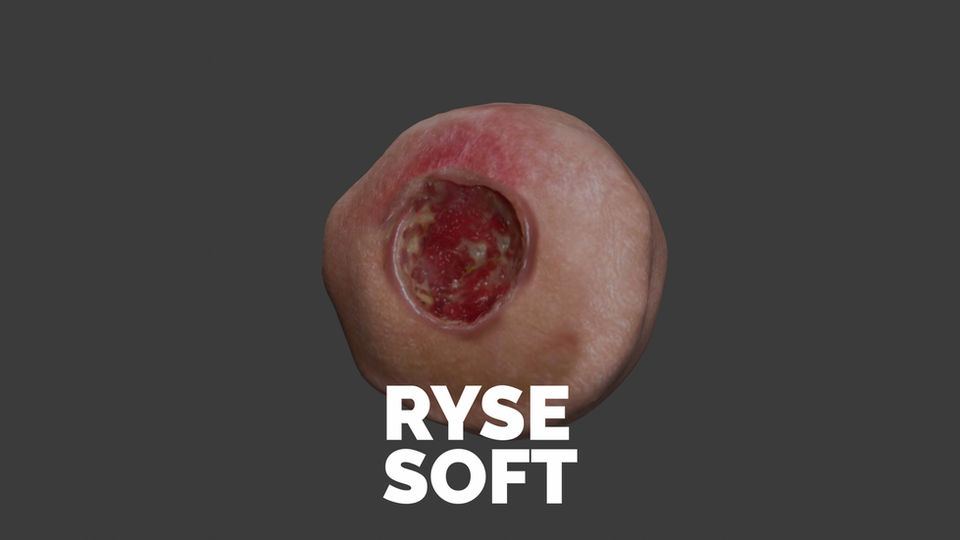 Bası Yaralanması Modelleri